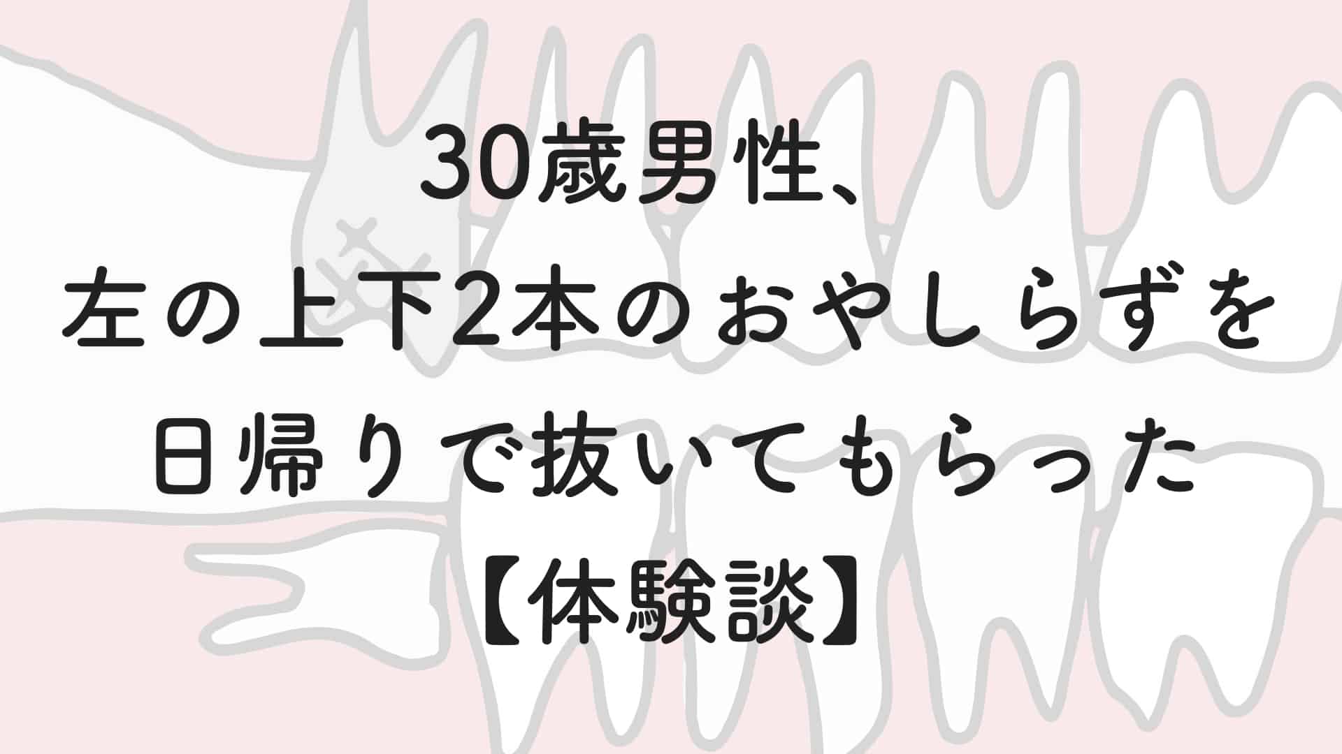 30歳男性 左の上下2本のおやしらずを日帰りで抜いてもらった 体験談 キルタイムブログ